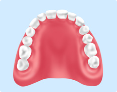 総入れ歯（総義歯）