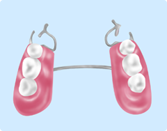 部分入れ歯（部分義歯）